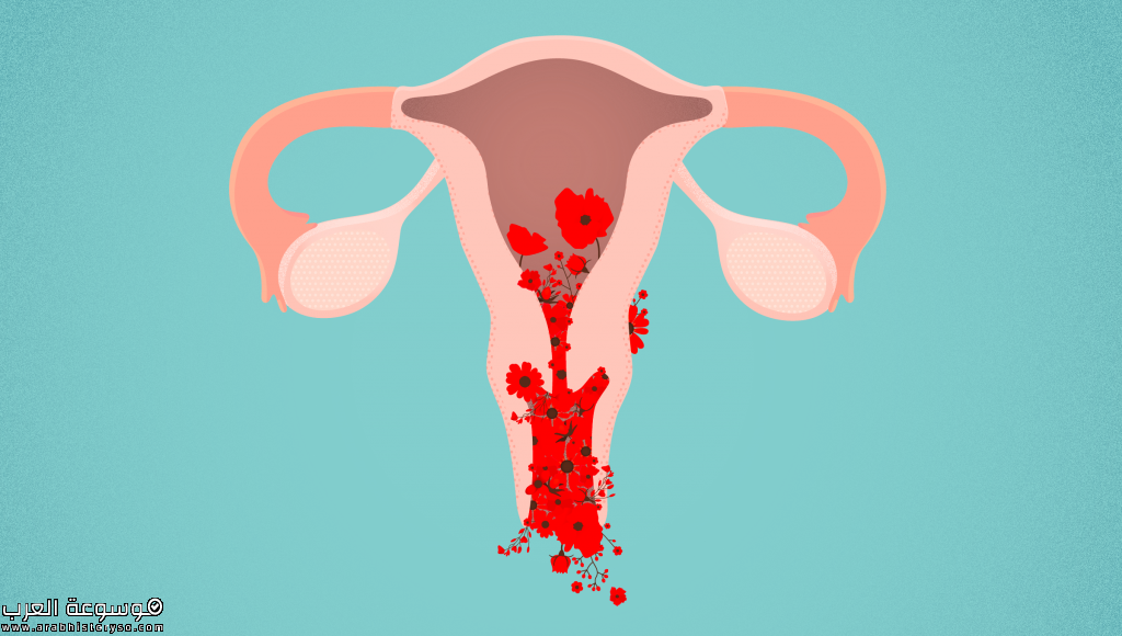 heavy-menstrual-bleeding-menorrhagia-causes-diagnosis-treatment